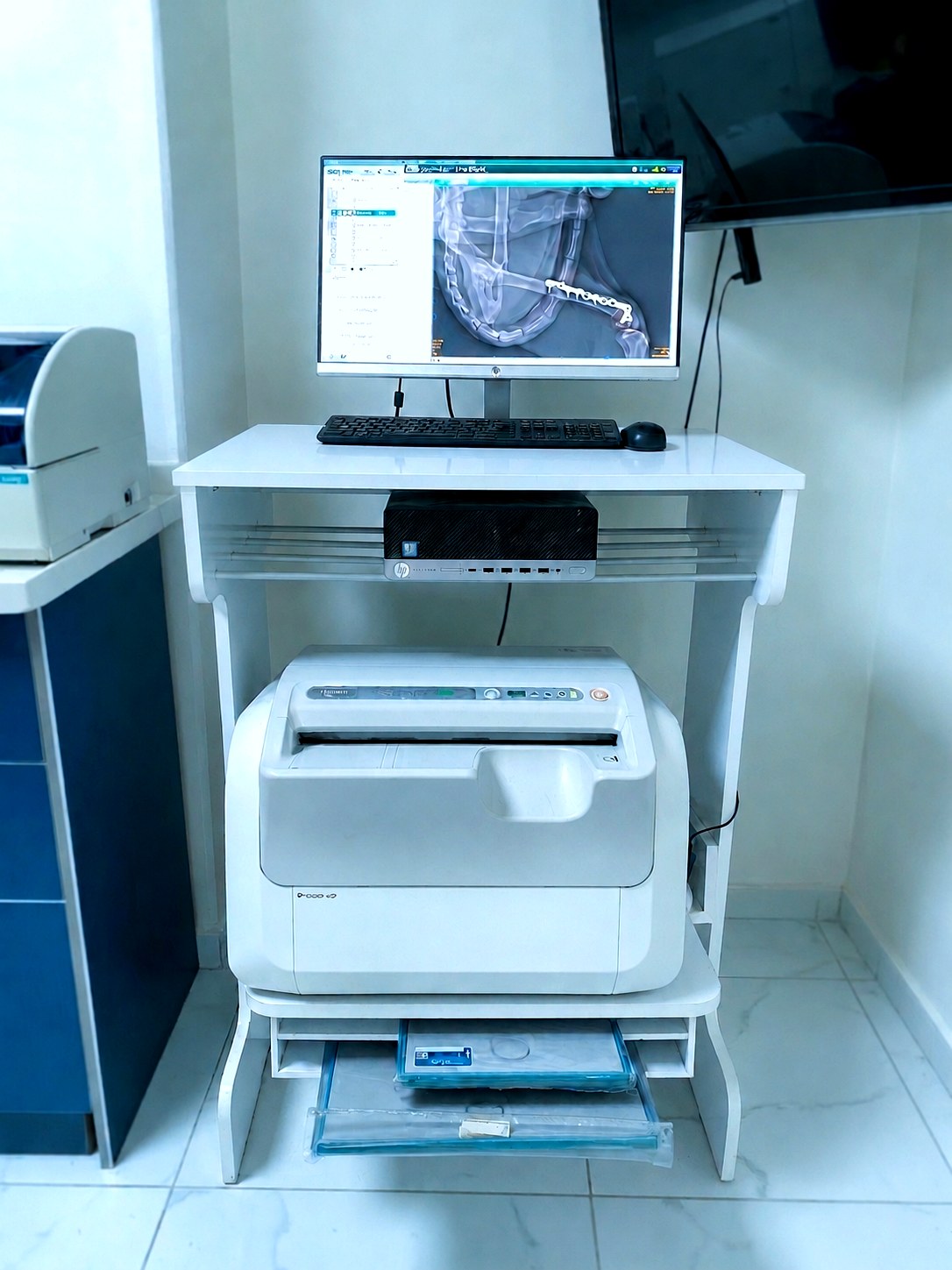 Dijital Röntgen Workstation